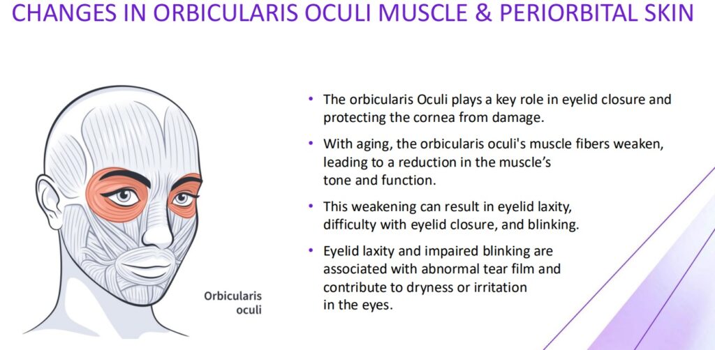 OptiLIFT informational image.