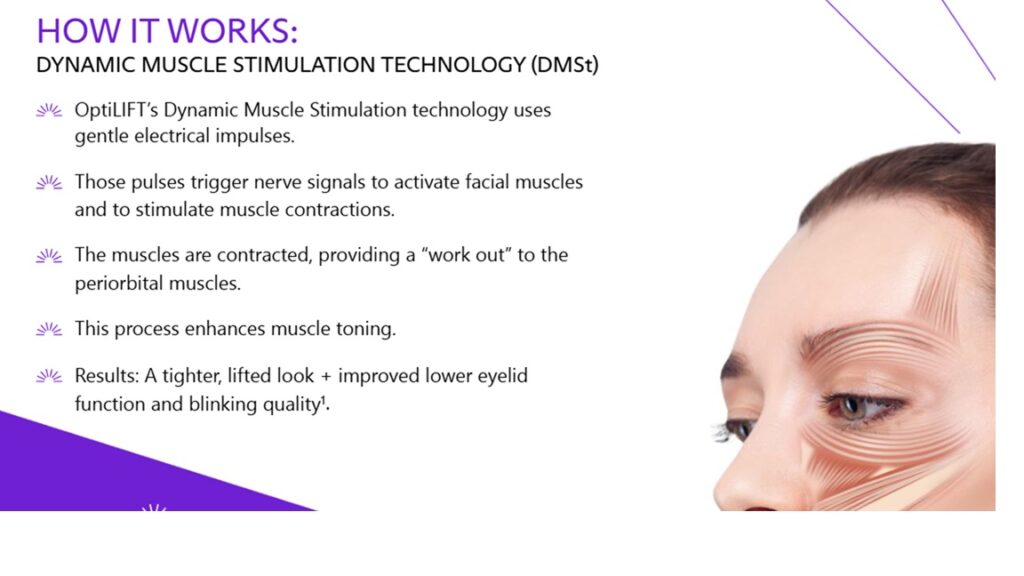An image describing how OptiLIFT works.