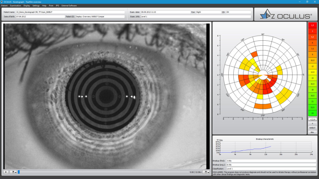 An image of test results on acomputer, with a black and white image of the eye next to some data.