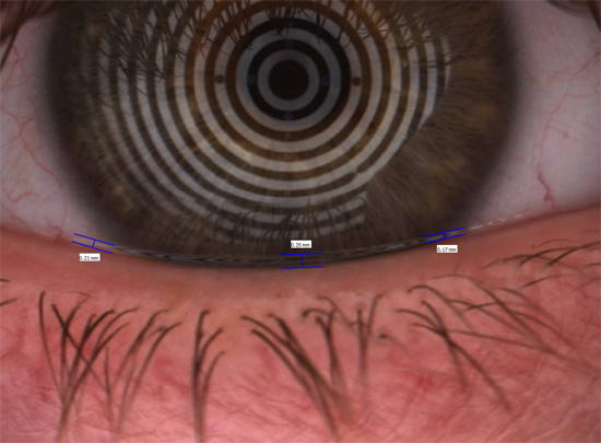 A close up of the human eye.